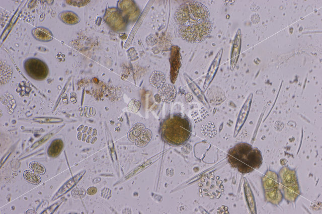 Desmids (Desmidiaceae)