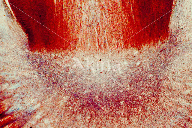 Moederkoren (Claviceps purpurea)