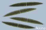 Closterium lunula lunula