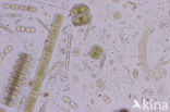 Desmids (Desmidiaceae)