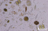 Desmids (Desmidiaceae)