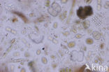 Desmids (Desmidiaceae)
